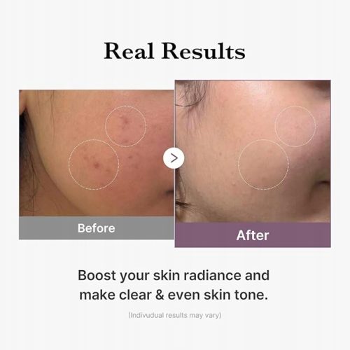 Medicube AGE-R Glutathione Glow Toner - Rozjaśniający Tonik 140ml - obrazek 4