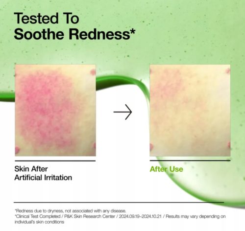 Anua Azelaic Acid 10 Hyaluron Redness Soothing Serum z Kwasami 30ml - obrazek 4
